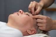 Acupuncture therapy. (Image via Freepik)